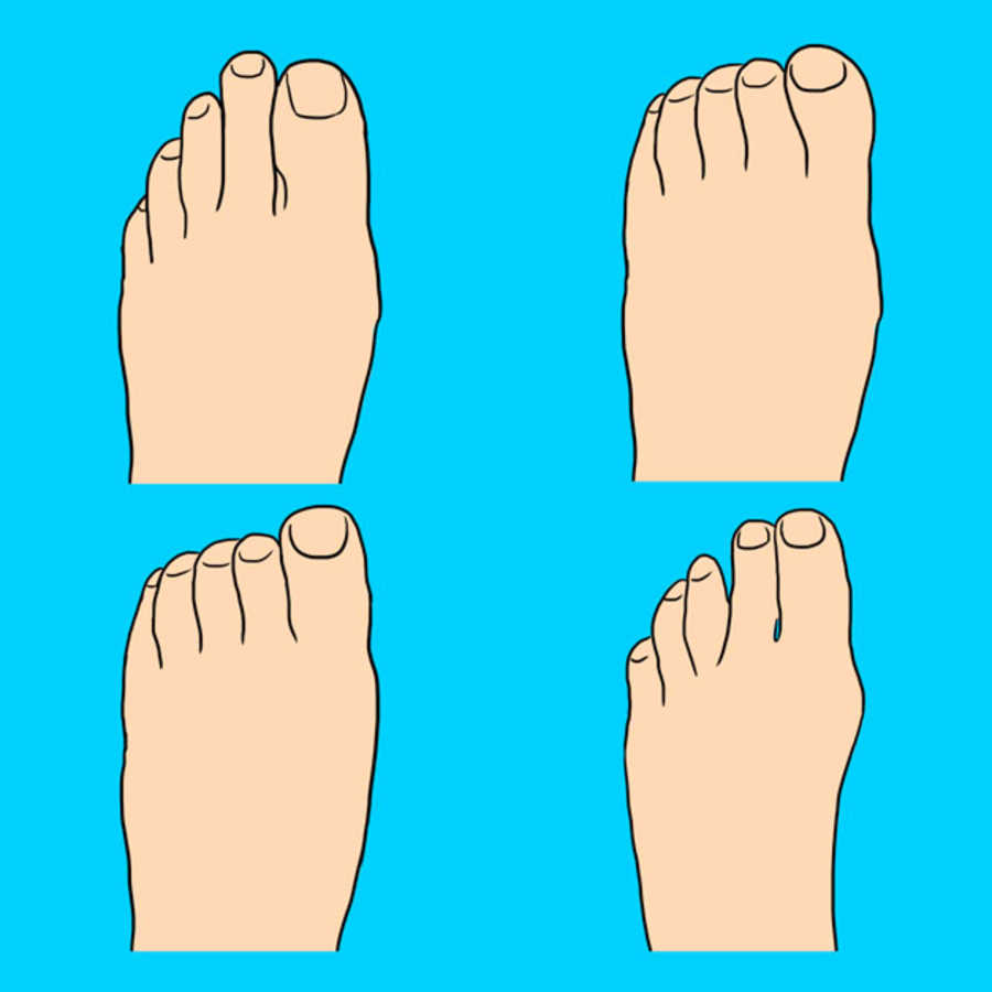 Your Toes Can Reveal Interesting Secrets About Your ...
