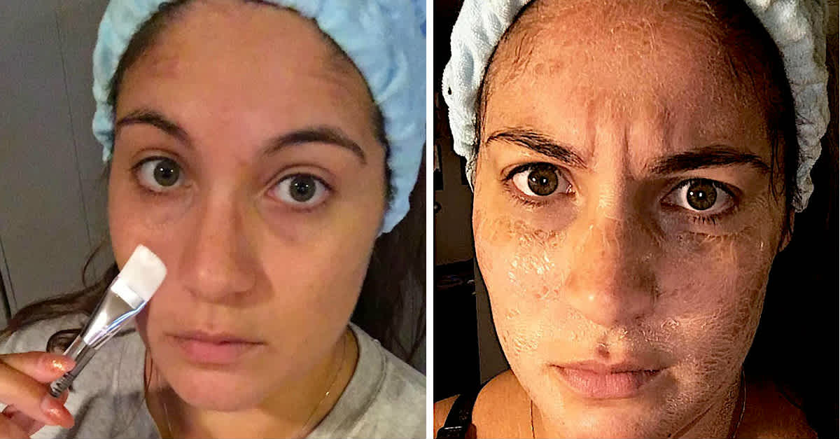 I Tried The Hanacure Mask, And What It Did To My Skin | LittleThings.com