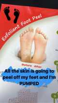 Baby Foot Review: 5 Women Tried It, and the Results Were Both Disgusting  And Satisfying