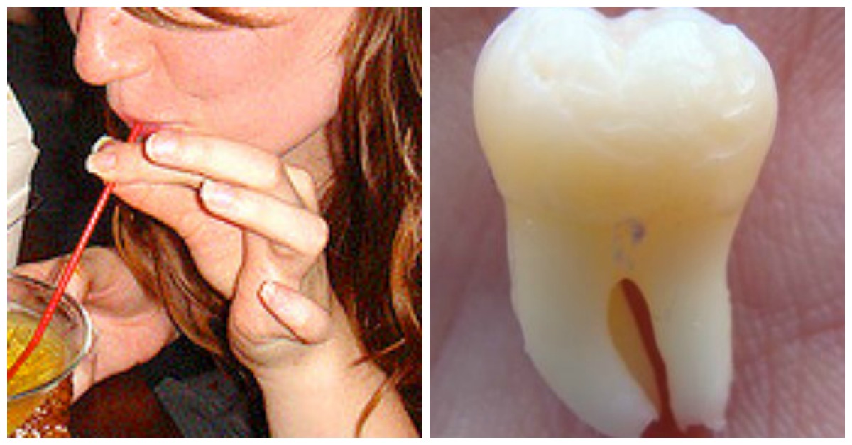 7 Dangers Of Drinking From A Straw