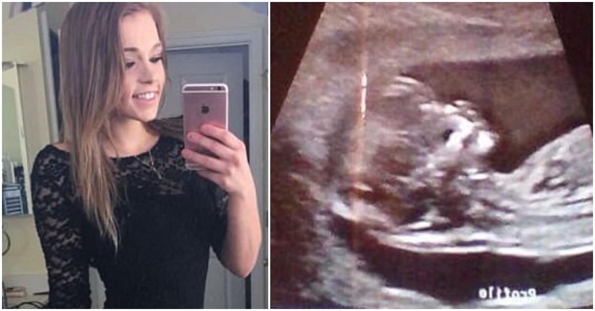 Strangers Accuse Teen Of Faking When She Shows Off Flat Stomach At 6 Months Pregnant