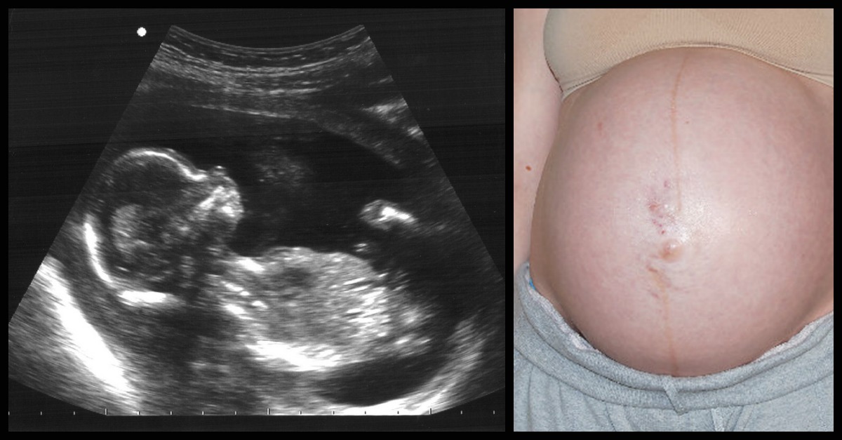 Do Babies Pee In The Womb? 10 Weird Things That Happen