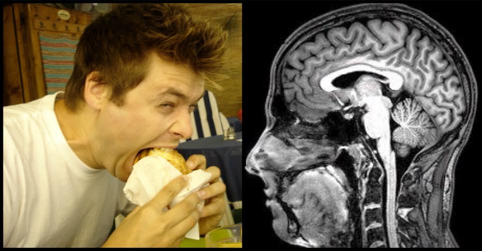 If You Hate The Sound Of Chewing, You May Have Misophonia