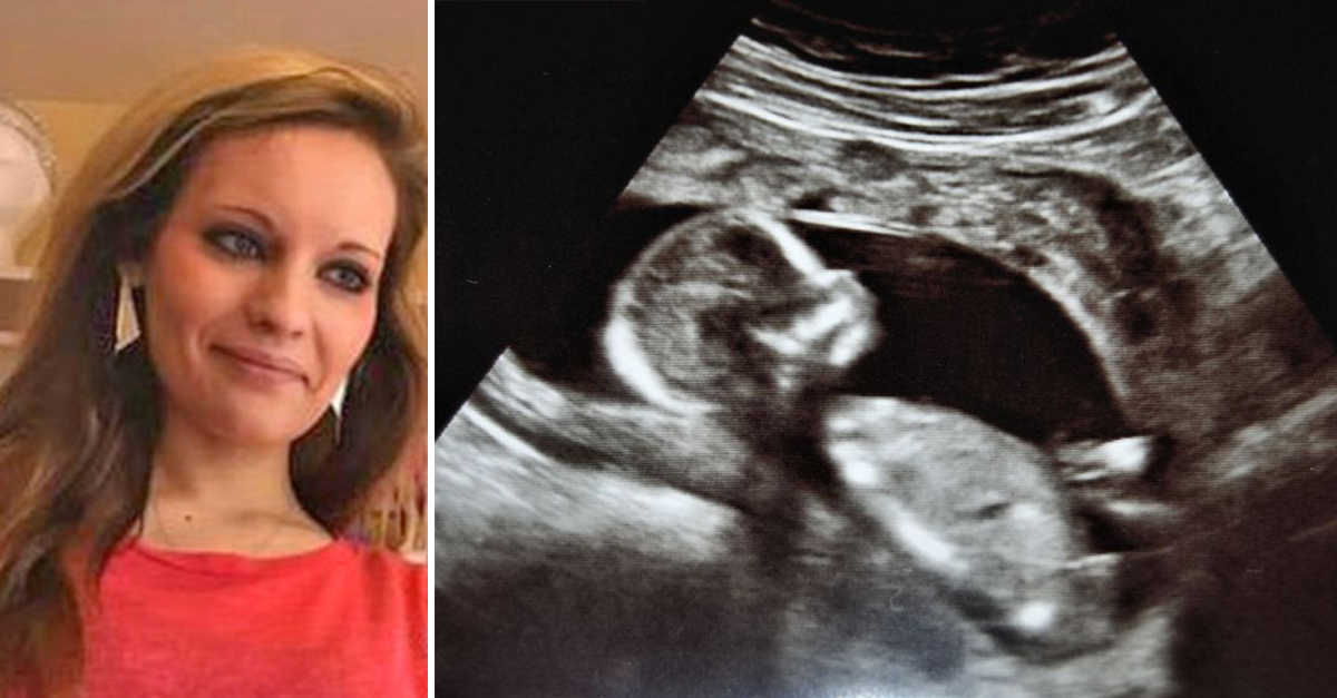 Ultrasound pictures twin missed Is this