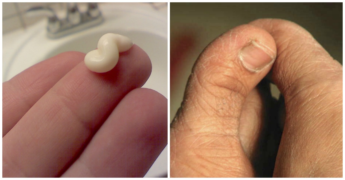 What Is Bad For Your Skin 10 Damaging Habits To Avoid