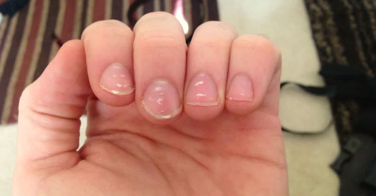Her Nails Were Dotted With Little White Marks. The Reason? I Had NO Idea! |  