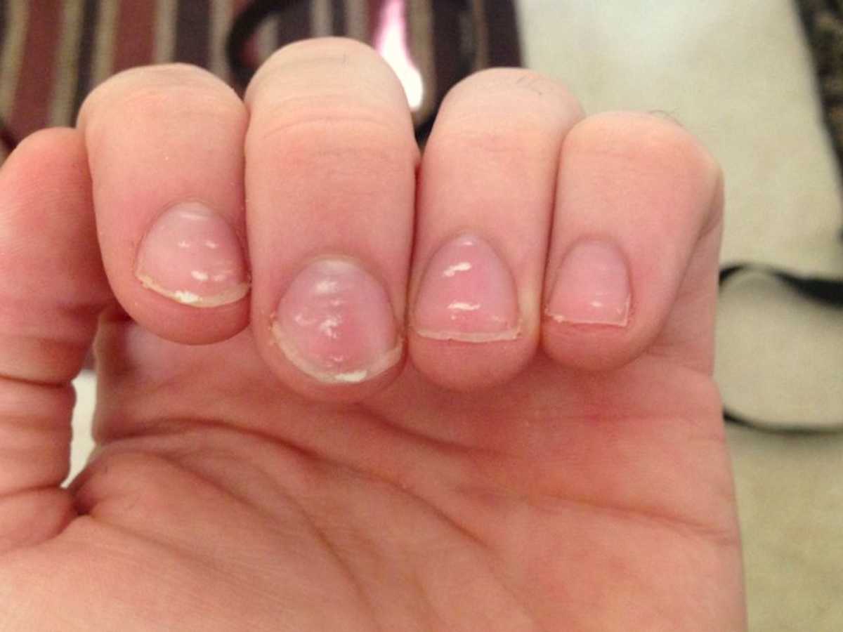 Her Nails Were Dotted With Little White Marks. The Reason? I Had NO Idea! |  