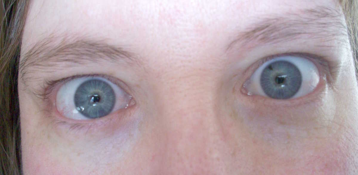 If You Have Blue Eyes, Science Says They're Actually Brown