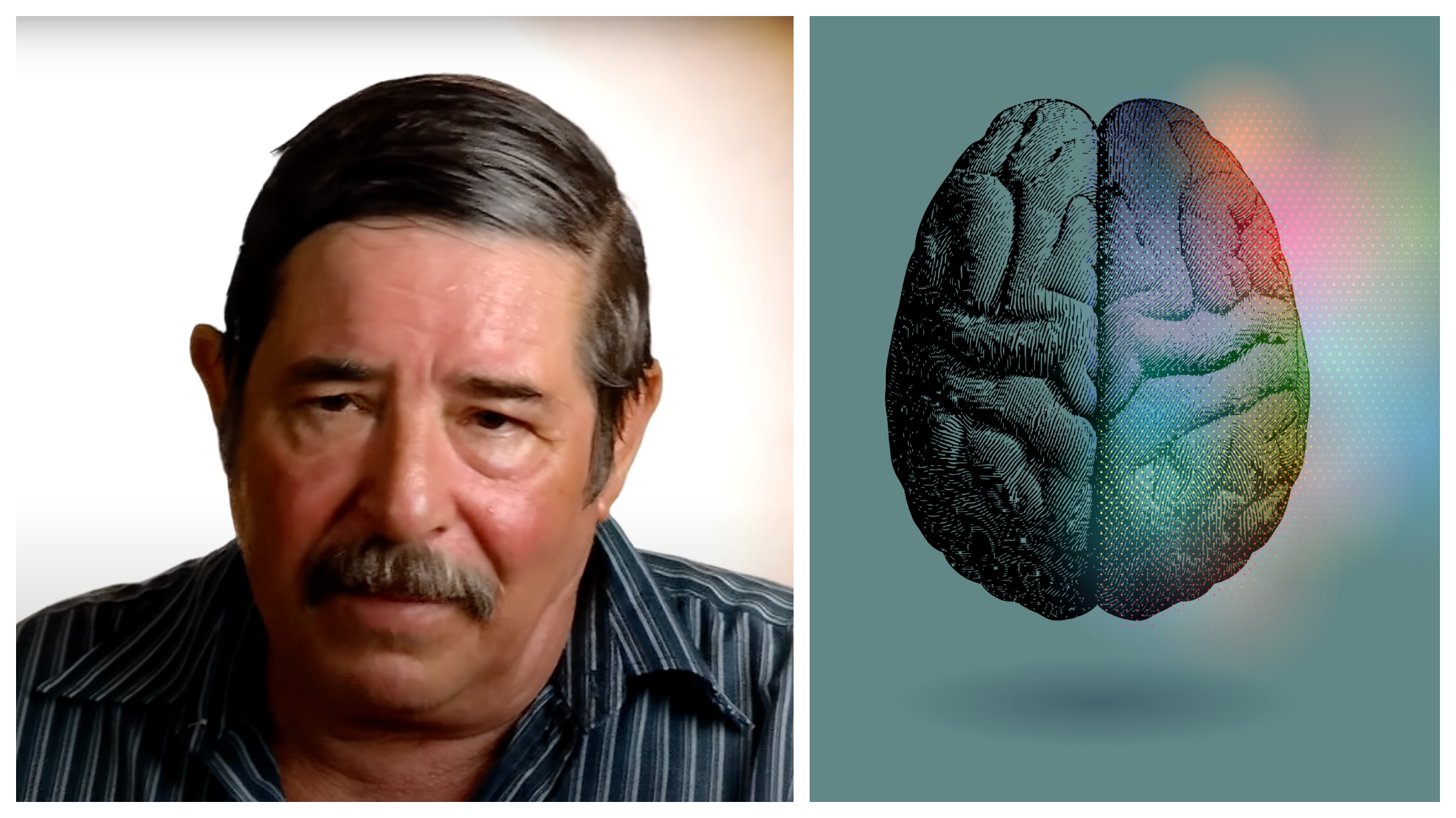 A Man Could Not Stop Belching And What Turns Out To Be The Cause Is