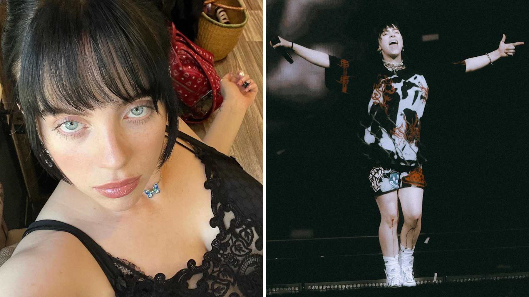 Billie Eilish Shares What It's Like To Be Laughed At Over Tics Due To