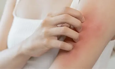 A person scratching their arm, highlighting an extra dry skin condition
