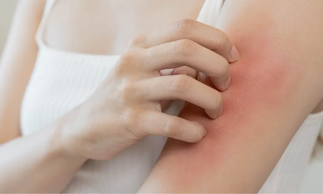 A person scratching their arm, highlighting an extra dry skin condition