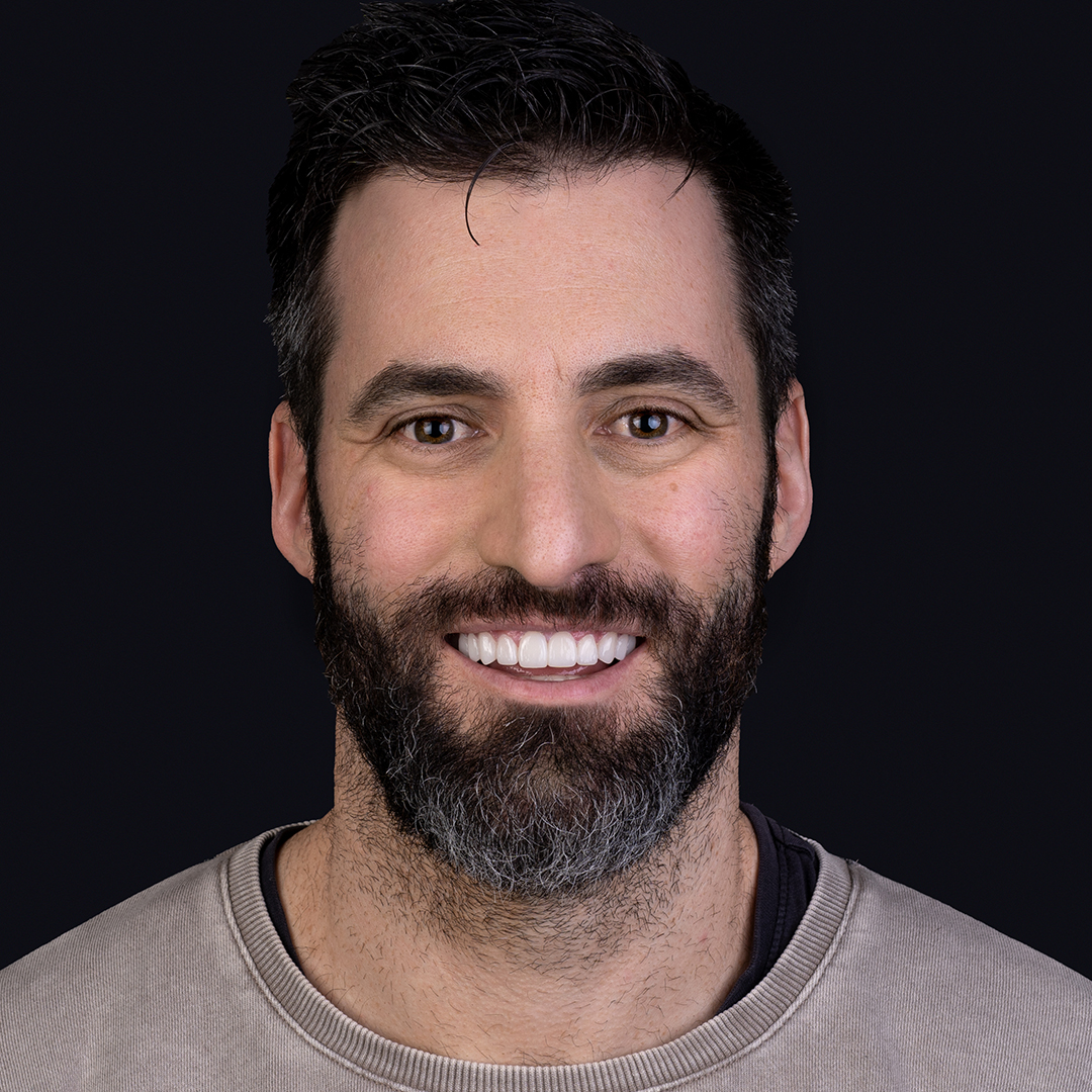 Anthony Cincotta with Picasso Porcelain Veneers® from Vogue Dental Studios