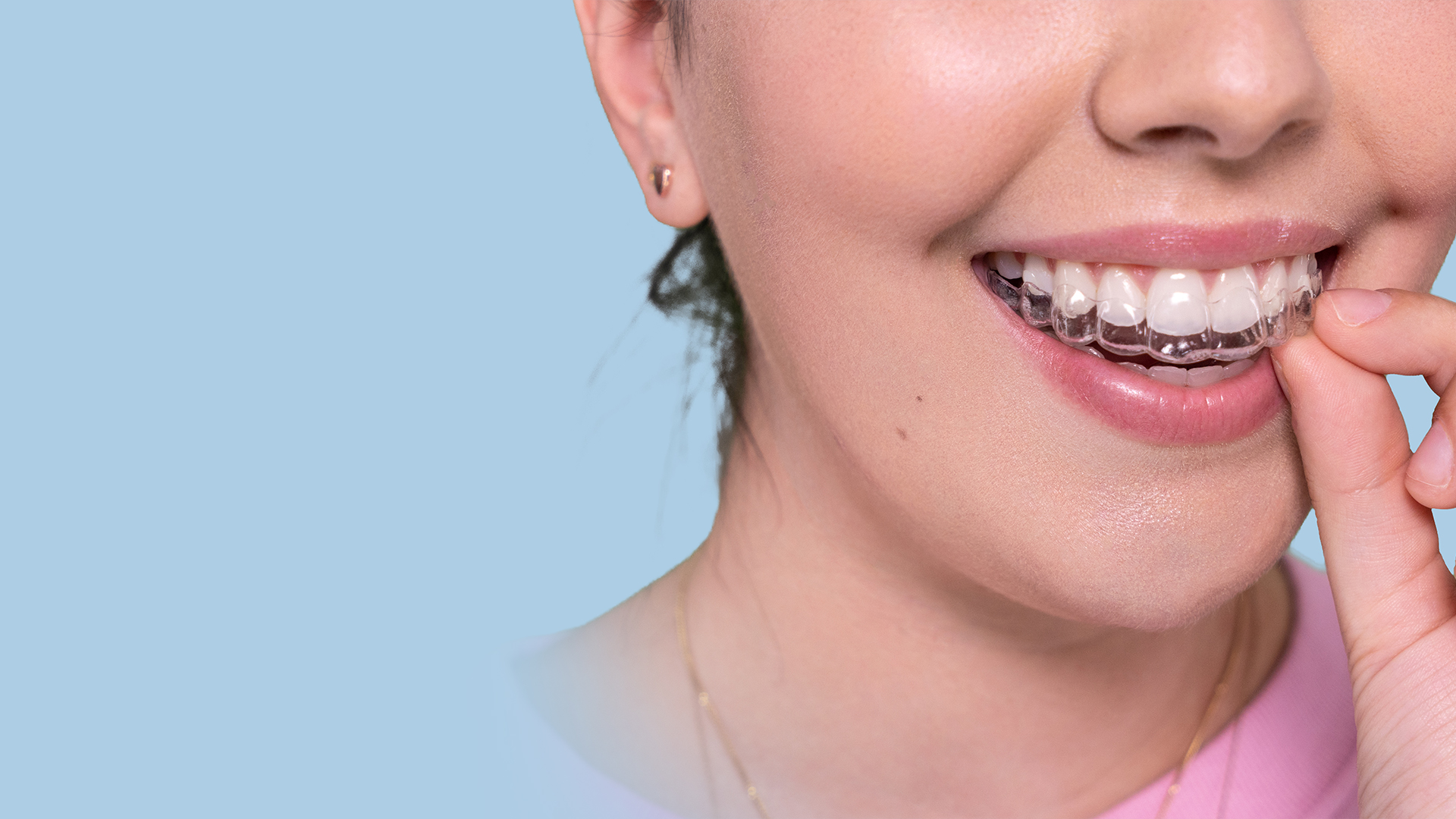 Emily putting on Invisalign aligners close up 