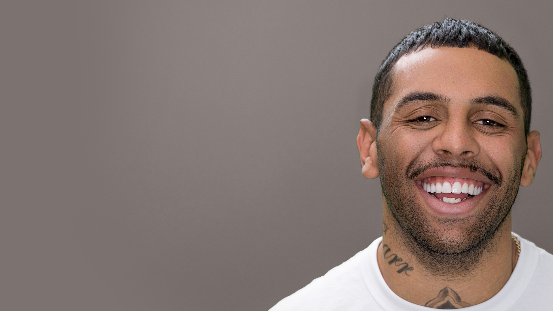 Josh Addo-Carr with porcelain veneers on his teeth at Vogue Dental Studios.