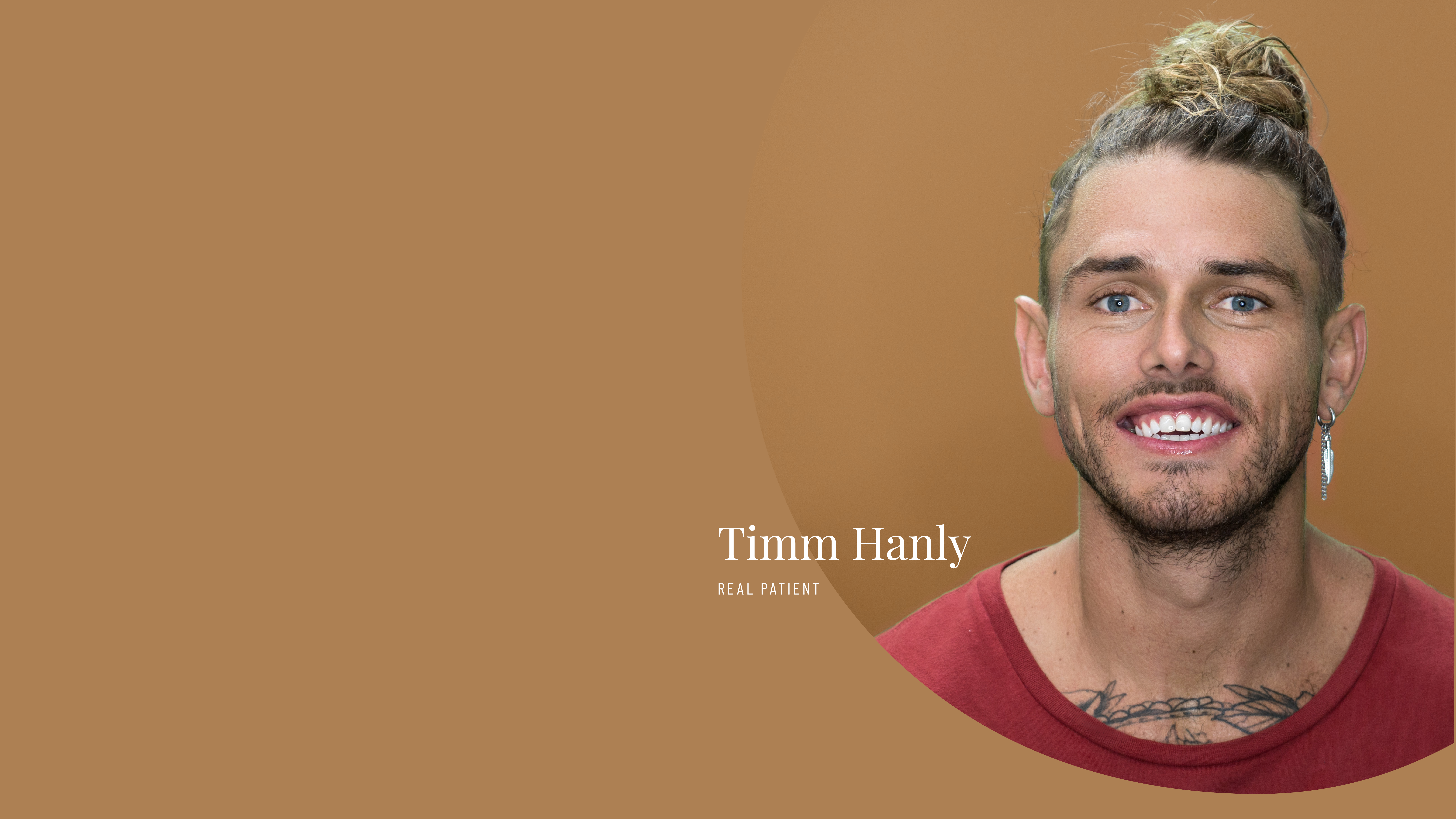 Timm Hanly from The Bachelorette became a Vogue Dental Studios patient for his regular checkups.