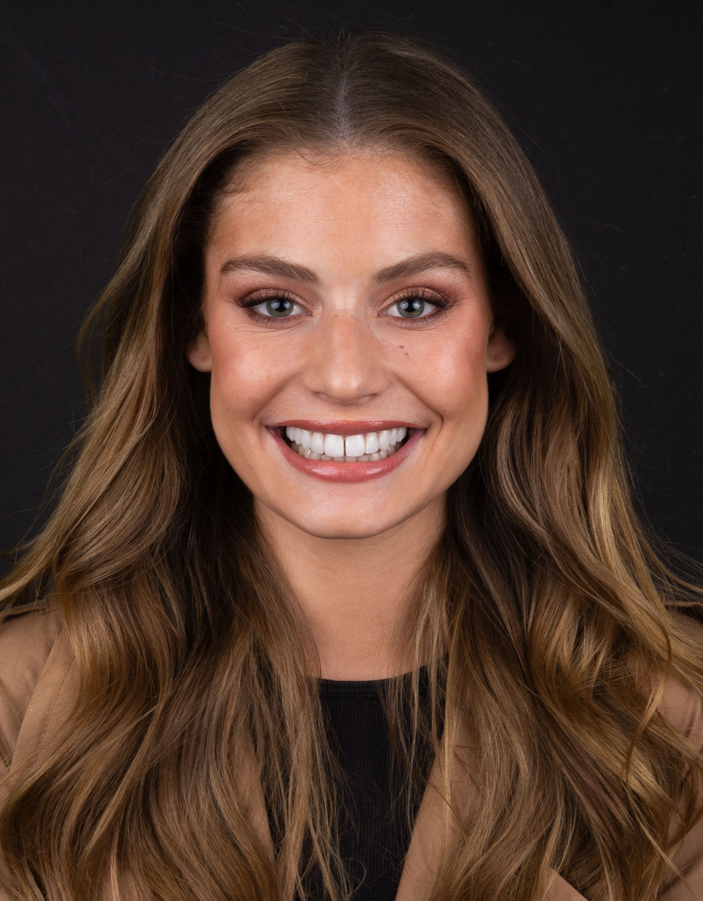 Moraya Wilson Miss Universe Australia before and after Pircasso Porcelain Veneers at Vogue Dental Studios 