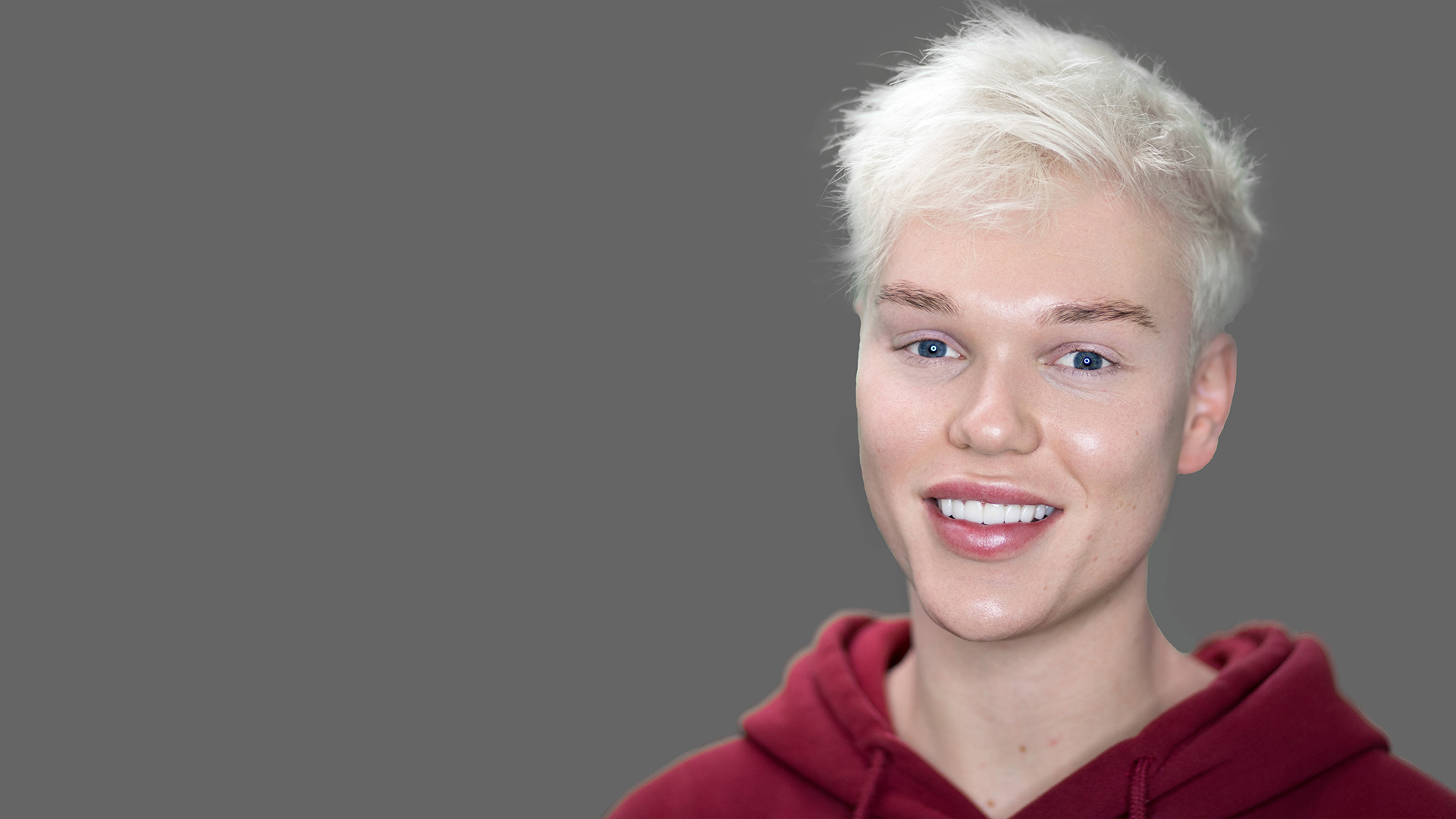 Jack Vidgen, from The Voice, with Picasso Porcelain Veneers by Dr Dee at Vogue Dental Studios.