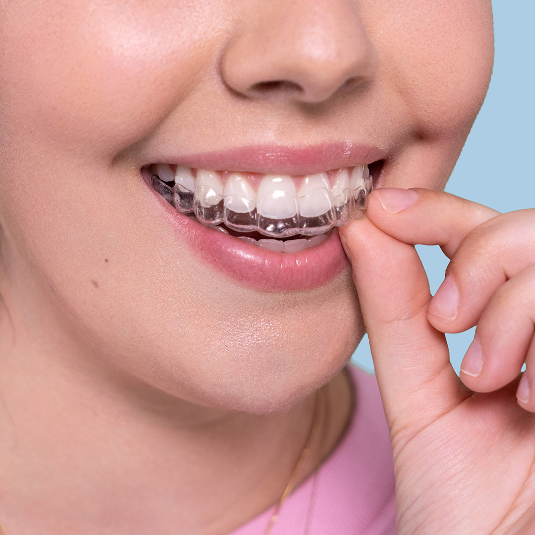 Invisalign Gold Invisalign Gold Coast - Clear Braces Treatment - Vogue - Vogue Dental ...
