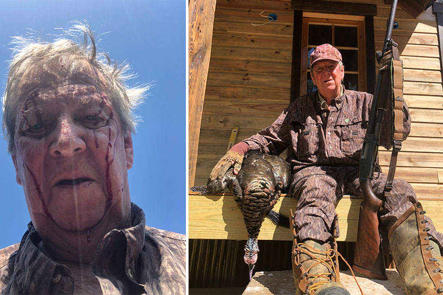 A Mississippi turkey hunter who was attacked by a bobcat. 