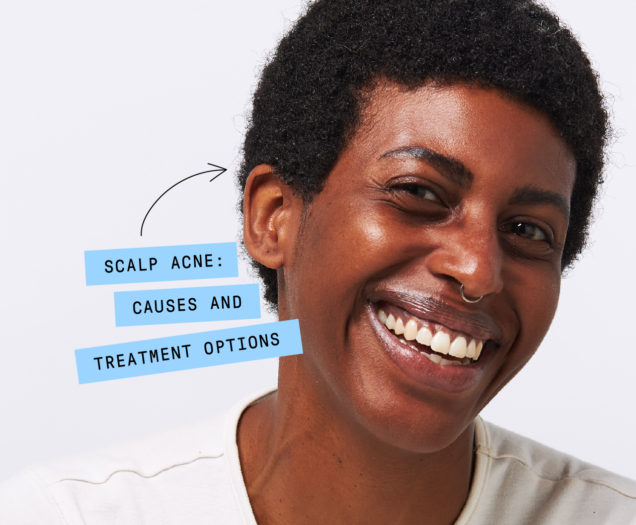 Scalp Acne: Causes and Treatment Options | Apostrophe