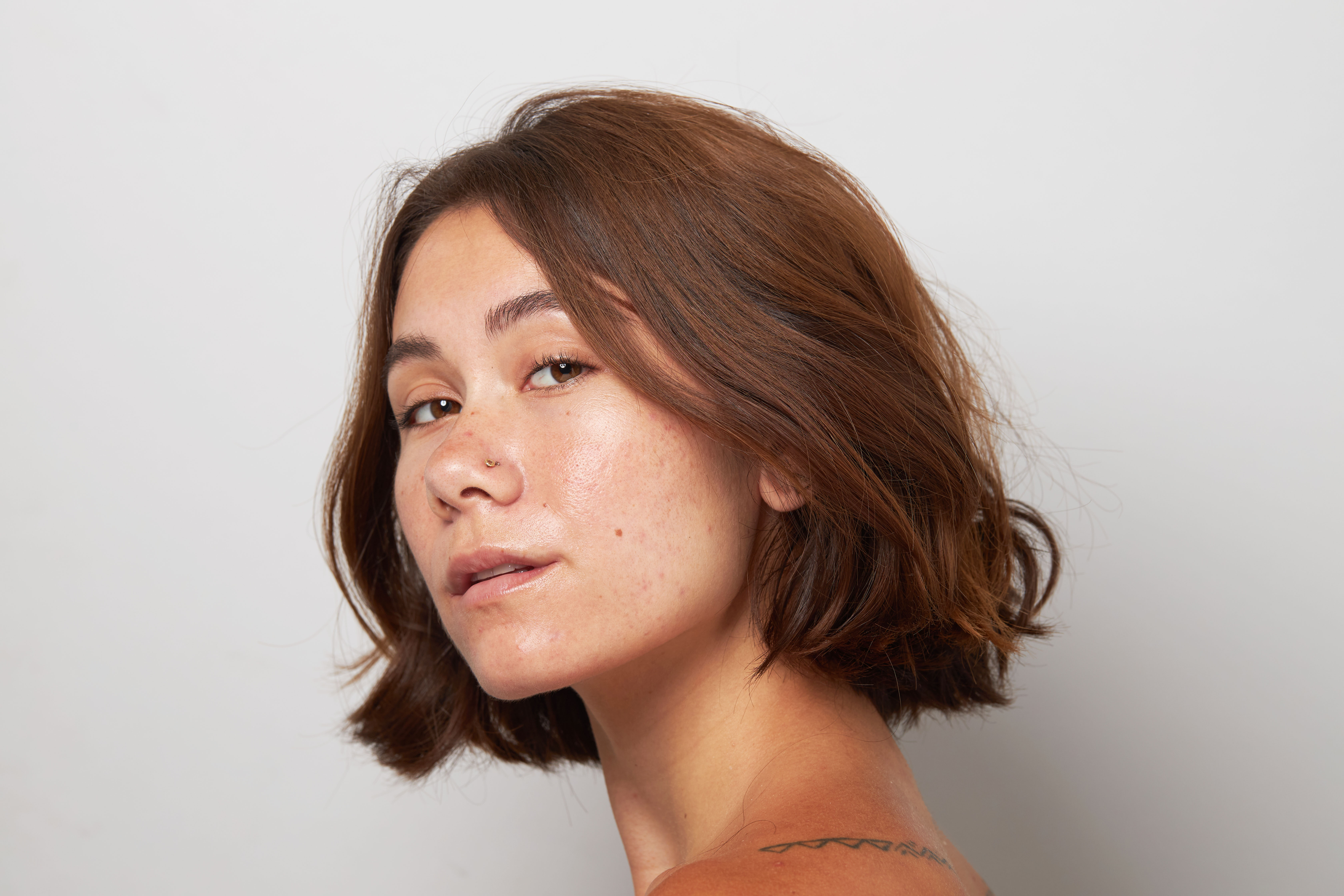 How To Remove Acne Scars Naturally Apostrophe