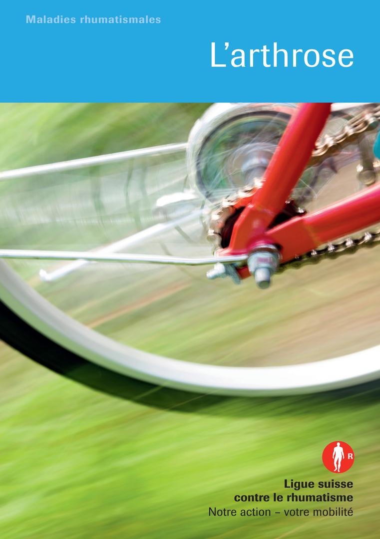 Titelbild Krankheitsbild Arthrose