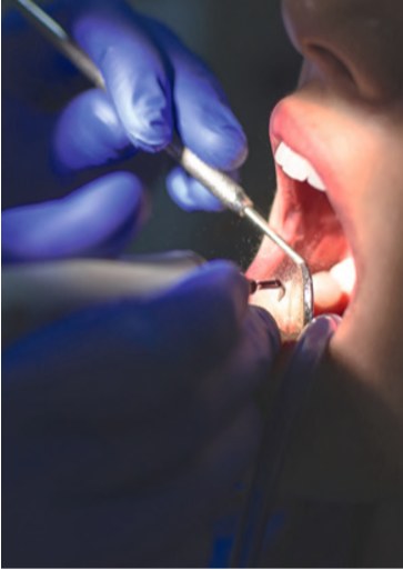 Titelbild_Wenn der soziale Status auch die Zähne betrifft