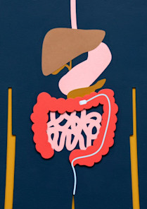 Colorectal cancer screening