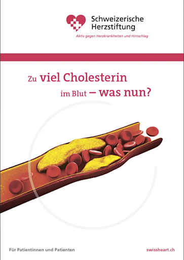 Titelbild_Zu viel Cholesterin im Blut - was nun?
