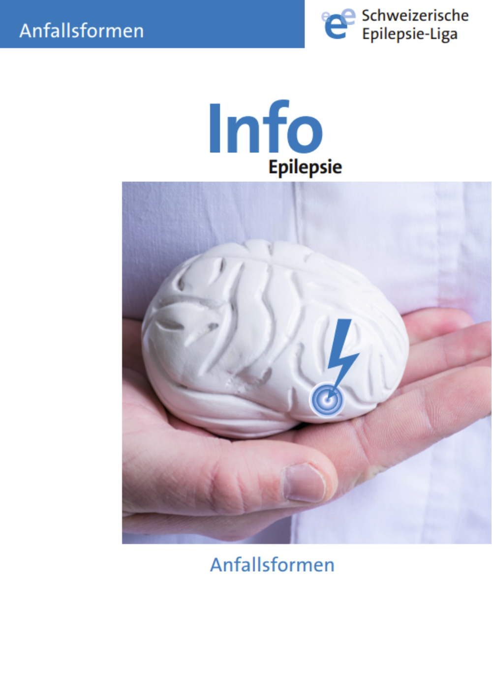 Titelbild Anfallsformen von Epilepsie DE