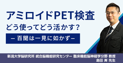 アミロイドPET検査 どう使ってどう活かす？ -百聞は一見に如かず-