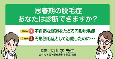 思春期の脱毛症　あなたは診断できますか？