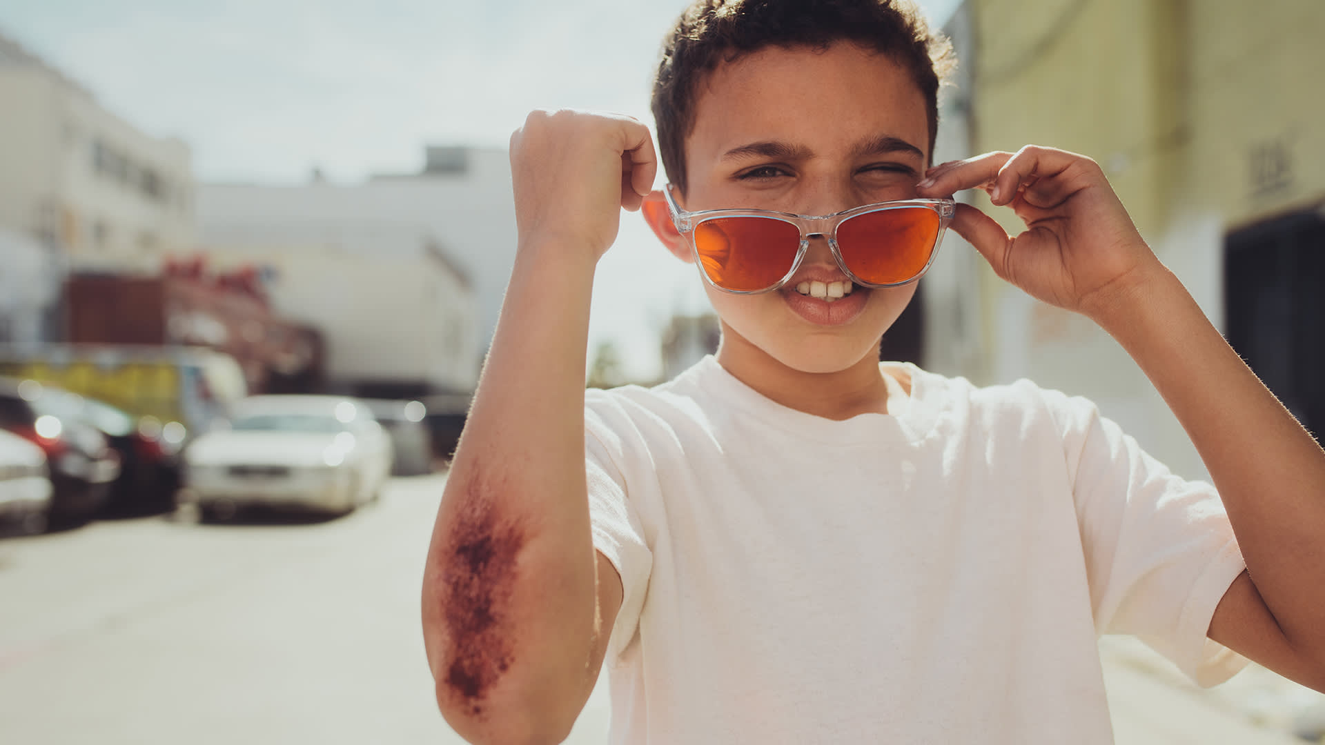 A boy in a white t-shirt smiles and lifts his sunglasses while standing outdoors. His right forearm has a scraped bruise. Cars and buildings are blurred in the background.