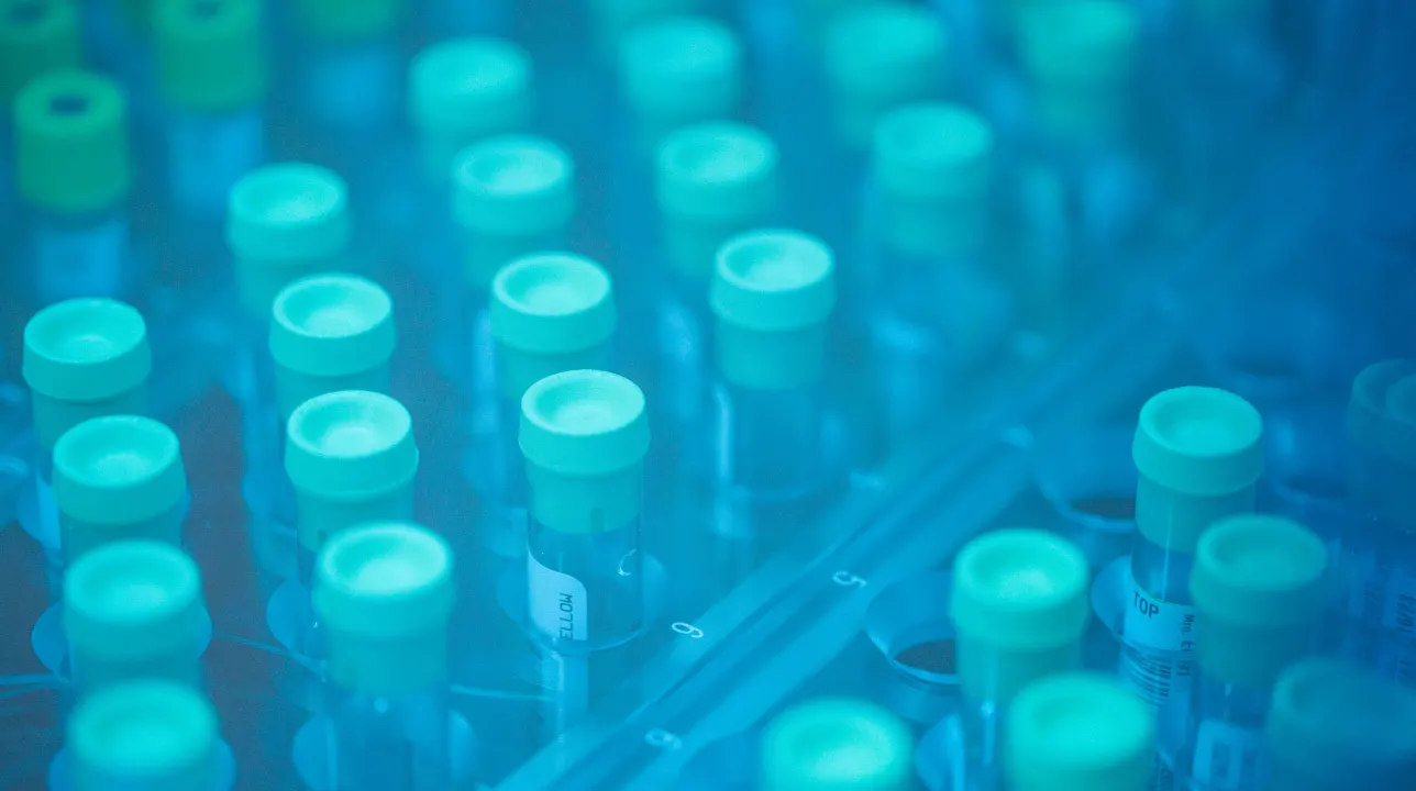 Rows of laboratory test tubes with green caps are arranged in a tray, viewed through a blue-tinted surface, creating a scientific and clinical atmosphere.