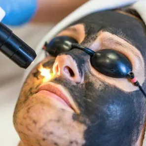 Laserowy peeling węglowy