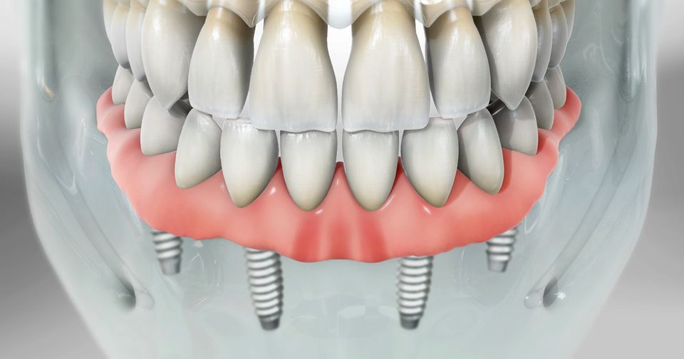 3d image of a mouth of teeth.