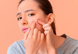 ¡Todo lo que necesitas saber sobre el acné! – Pomys