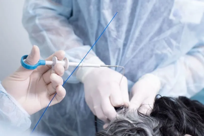 Endoscopy for Cats & Dogs