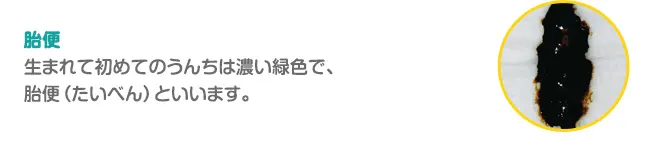 胎便