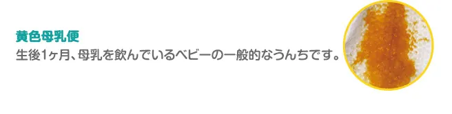黄色母乳便