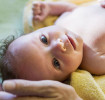 乳児脂漏性湿疹の赤ちゃん 