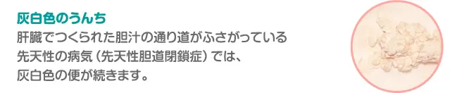 灰白色のうんち