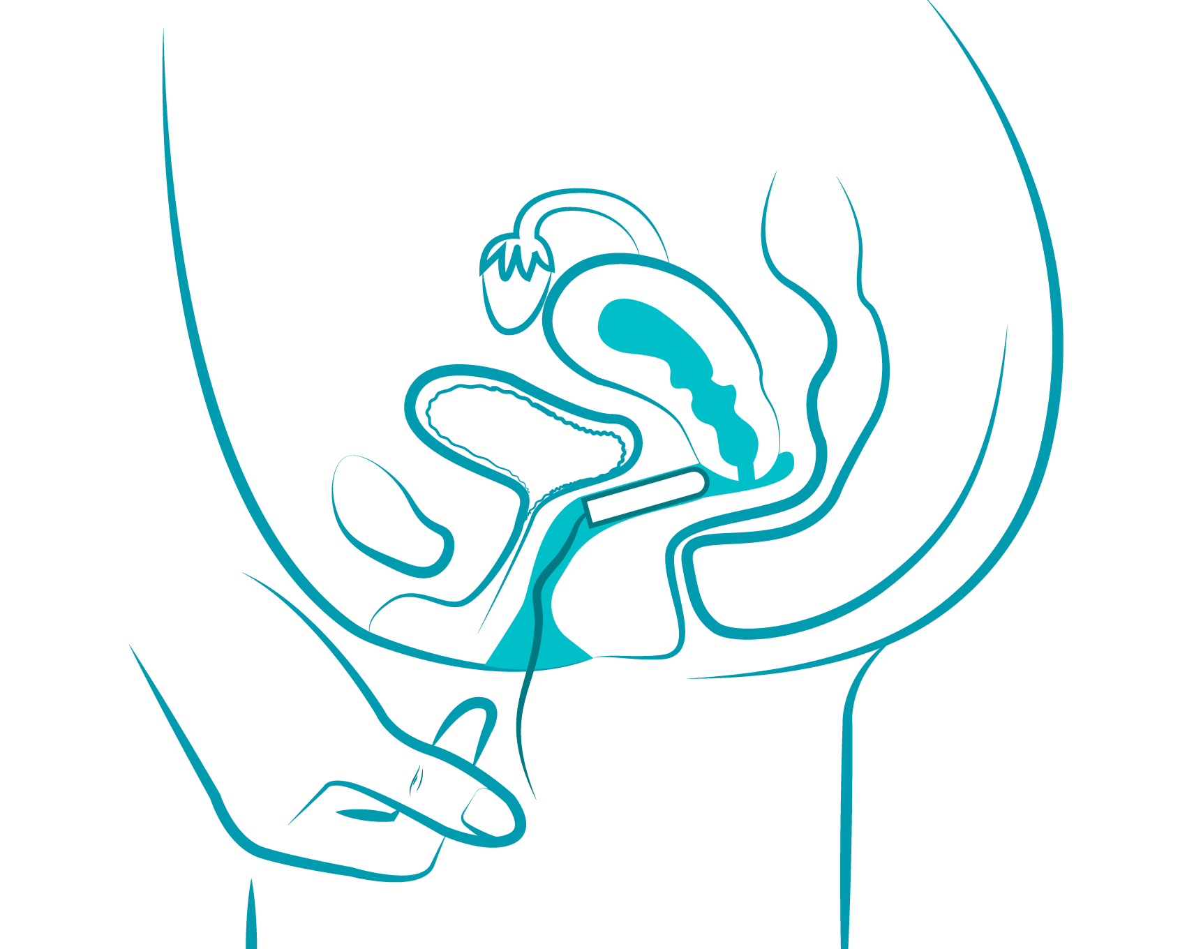 ob tampon application illustration