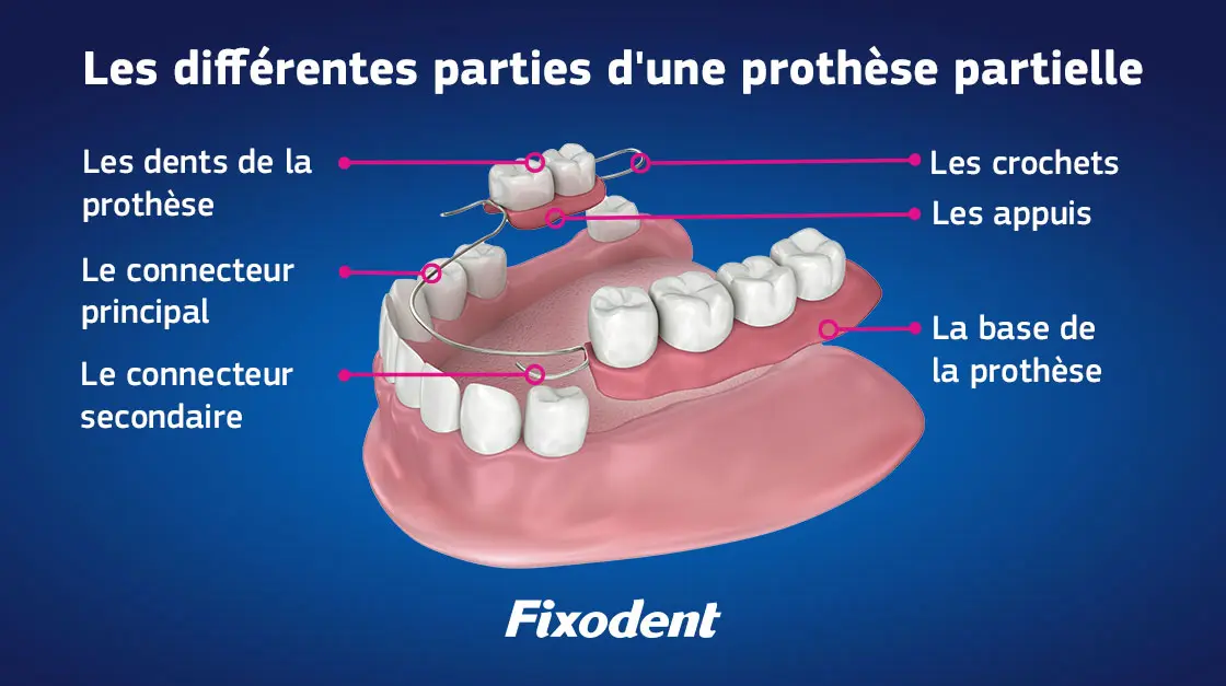 Séparateur De Dents Dentaire – 1 Pièce – Outil Pour Caler Et Retenir Les Dents Antérieures/postérieures
