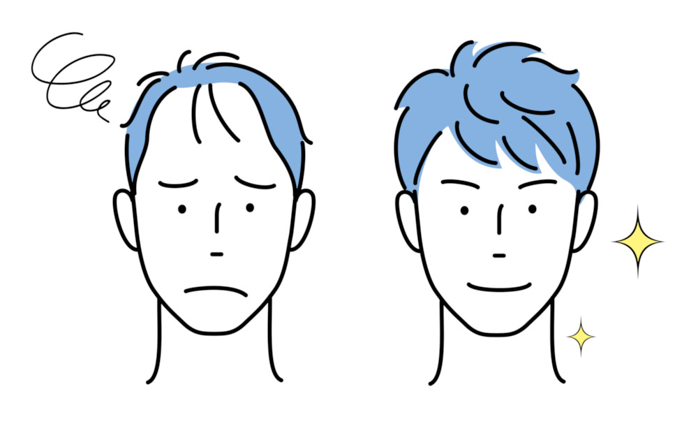 male-hormone-hair-3