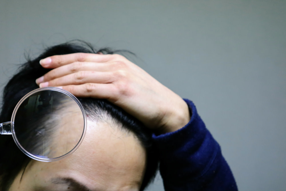 【ドクター監修】AGAの前兆とは？要因となる行動や対処法も解説|ヘアケアラボ