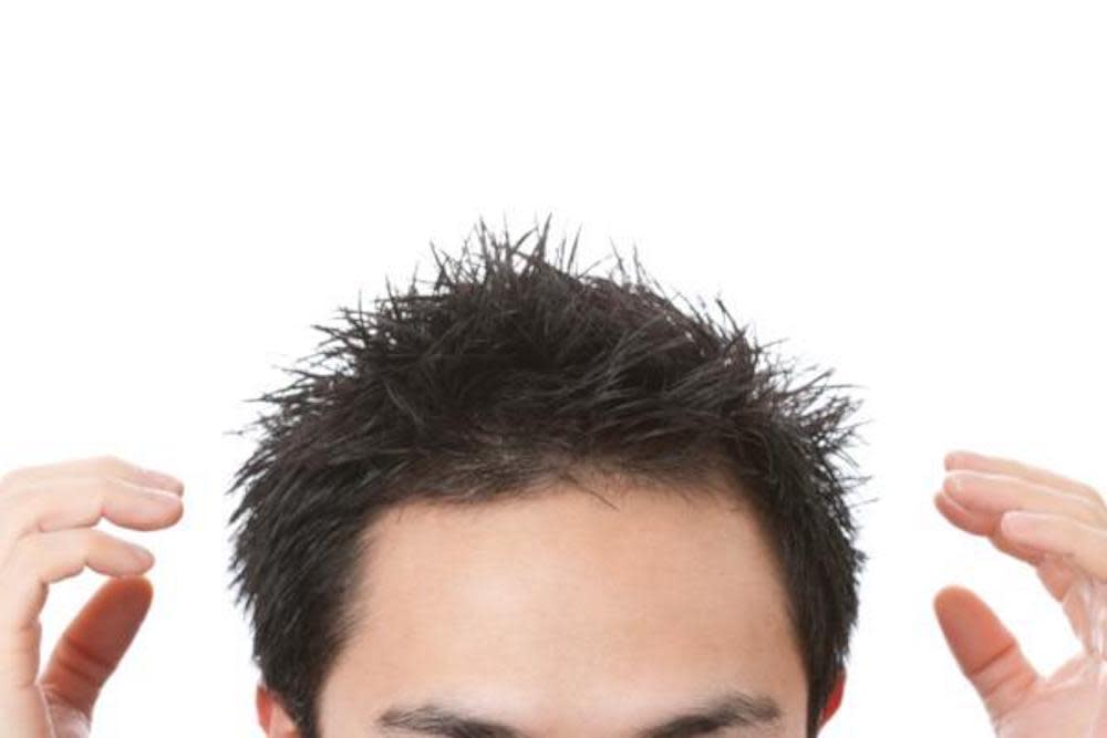 scalp-care-mens-thinning-hair-2