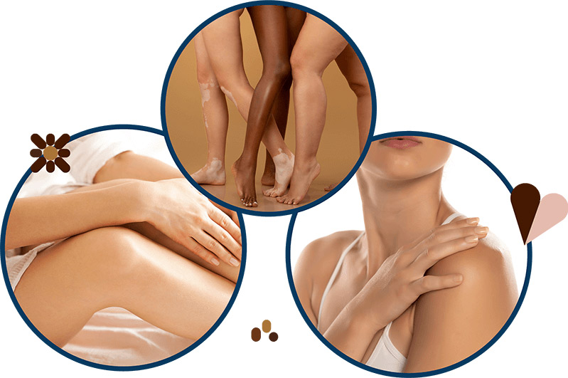 Skin Health - Toda parte del cuerpo