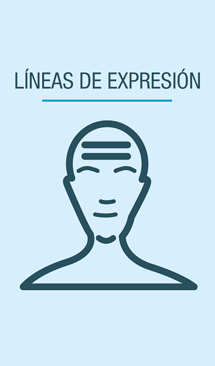 Líneas de expresión